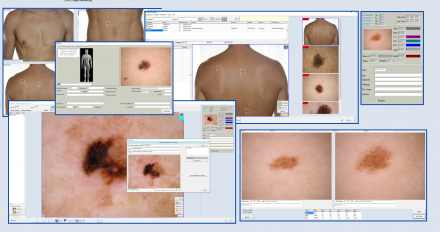 Un Efficiente e Completo Database Pazienti - Software per Dermatologia e Dermatoscopia 