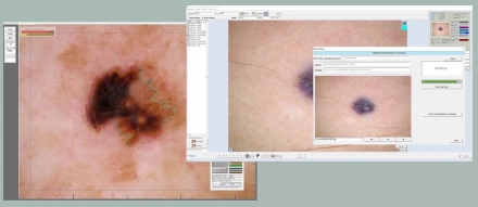 La Nostra StartUp Italimaging - Software per Dermatologia e Dermatoscopia 